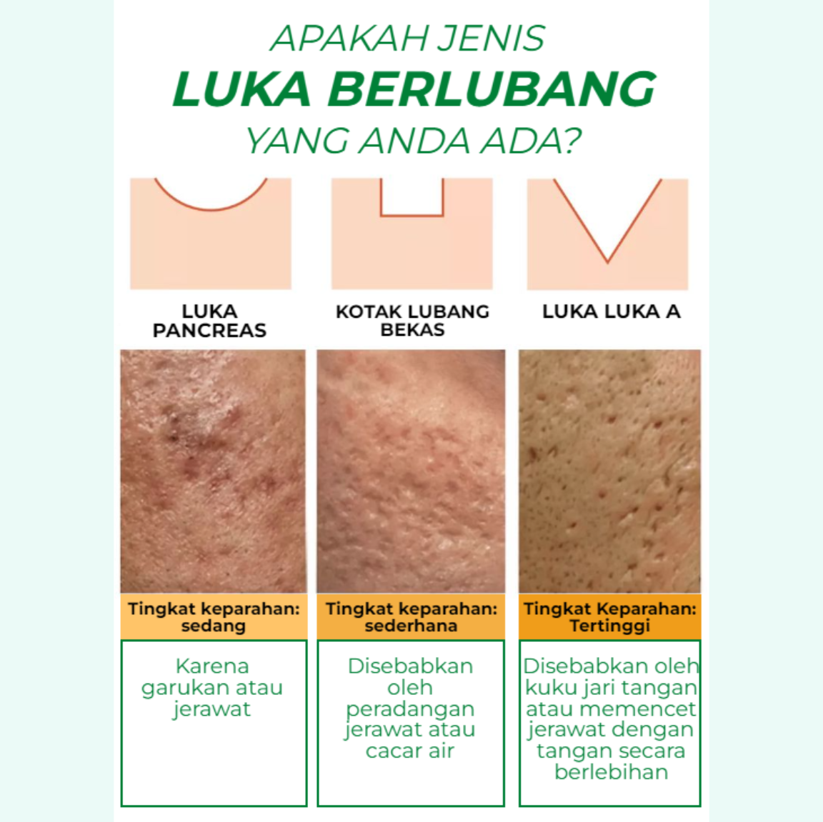 Serum Penghilang Bopeng VERBLE - Serum Day and Night