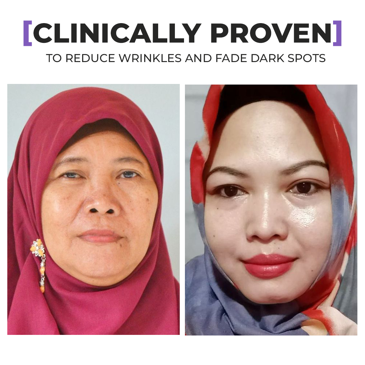 Paket GLOW Mini Duo